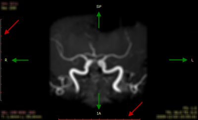 RadiAnt_DICOM_Viewer_Annotations_Rulers_Orientation