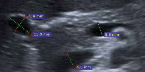 Ultrasound region calibration is used.