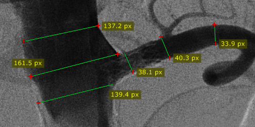 There is no calibration data available (measurement in pixels of the source DICOM image).