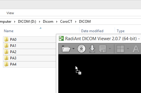 RadiAnt_DICOM_Viewer_DragAndDrop_Folder