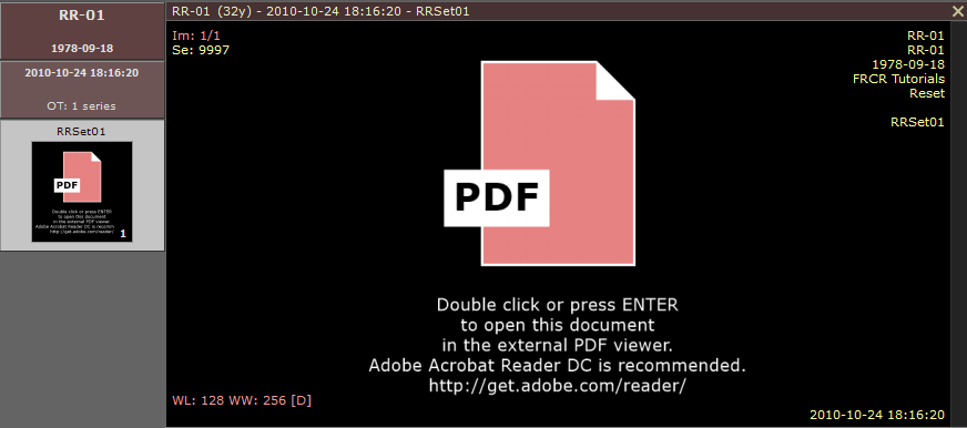 RadiAnt_DICOM_Viewer_Encapsulated_PDF_Screen