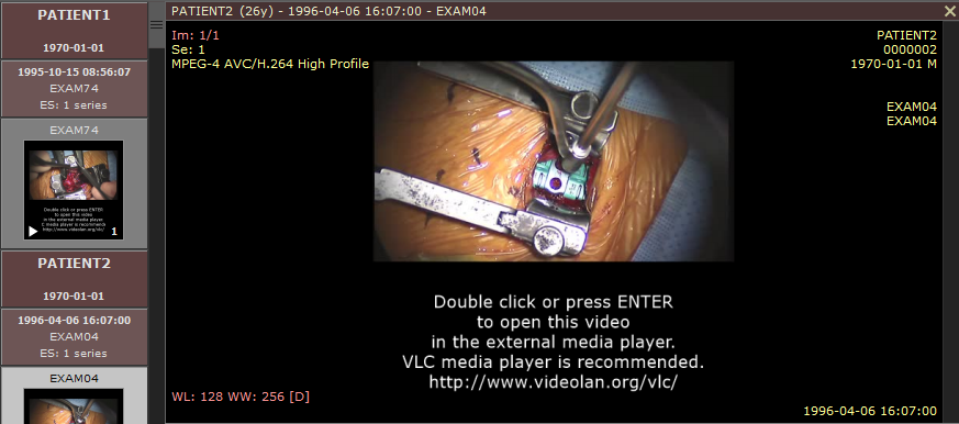 RadiAnt_DICOM_Viewer_MPEG2_MPEG4_Video_Screen_FFMPEG_Preview_Frames