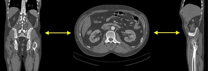 RadiAnt_DICOM_Viewer_MPR_Example