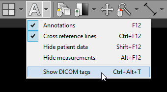 RadiAnt_DICOM_Viewer_Show_DICOM_Tags_DropDownMenu