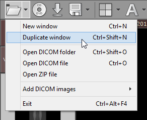 RadiAnt_DICOM_Viewer_Windows_DuplicateWindow