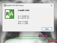 Blog image - RadiAnt DICOM Viewer 2023.1