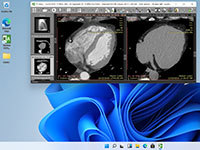 Blog image - RadiAnt DICOM Viewer ready for Windows 11!