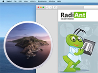 Blog image - RadiAnt DICOM Viewer on macOS Catalina