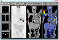 Blog image - RadiAnt DICOM Viewer 1.0.4 Release Candidate