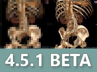 Blog image - RadiAnt DICOM Viewer 4.5.1 BETA with GPU accelerated VR