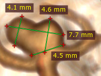 Blog image - RadiAnt DICOM Viewer 2.9.2 BETA