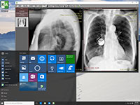 Blog image - RadiAnt DICOM Viewer ready for Windows 10!