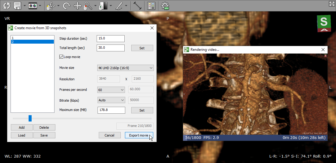 radiant dicom viewer 4.2.1 crack