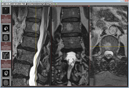 RadiAnt Viewer Portable 1.1.8.4646 free download. A DICOM viewer for