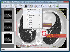 Radiant Dicom Viewer Download Mac Radiant Dicom Viewer Download Mac