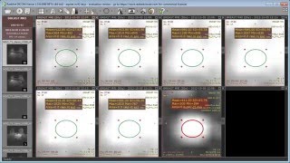 RadiAnt DICOM Viewer 1.3.9 BETA - new features