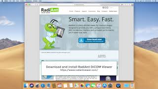 RadiAnt DICOM Viewer on macOS Mojave