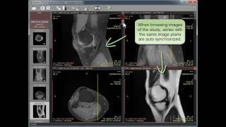 RadiAnt DICOM Viewer 0.35 - new features