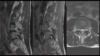 3D Cursor in RadiAnt DICOM Viewer 4.5 BETA