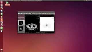 RadiAnt DICOM Viewer on Linux