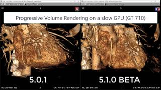 Progressive GPU accelerated Volume Rendering