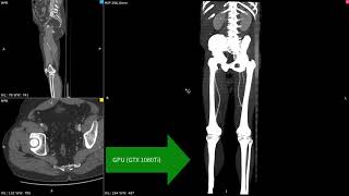 GPU acceleration in 3D MPR - RadiAnt DICOM Viewer 4.5 BETA