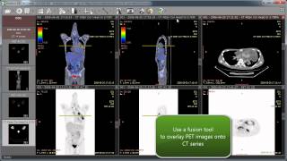 RadiAnt DICOM Viewer 1.0.4 - new features